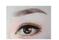 呼和浩特市做切开法双眼皮后恢复要多久呢?