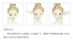 呼和浩特市吸脂能够去眼袋吗?