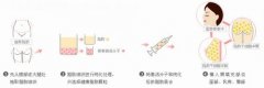 呼和浩特整形医院自体脂肪填充的风险大吗?