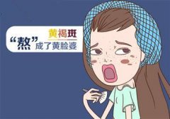 呼和浩特整形医院如何消除脸上黄褐斑呢?