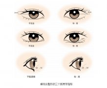 呼和浩特双眼皮修复效果怎么样?