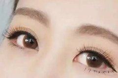呼和浩特市整形医院做一次美瞳线需要多少钱?