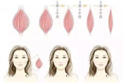 注射瘦脸针后有哪些注意事项?