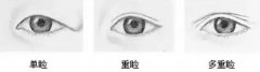 呼和浩特哪家医院割双眼皮效果好?