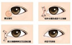 为什么眼睛看着不大不够亮呢?