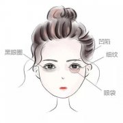 呼市整形玻尿酸填充修复深眼窝效果好吗?