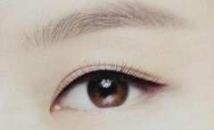 呼和浩特整形做美瞳线后要注意什么?