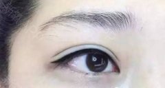 呼市整形美瞳线和眼线的区别有哪些?
