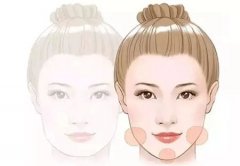 哪些方法可以去除眉间纹?