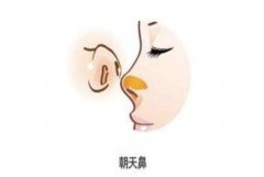 鼻修复前必看,别再让你的鼻子受伤了!呼和浩特市整形医院