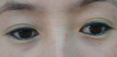 女性纹眼线有哪些危害呢?