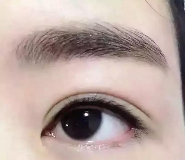 呼和浩特整形