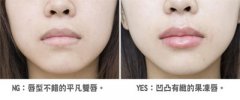 呼市丰唇的方法有哪些?