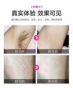 呼和浩特激光脱毛有危险吗?