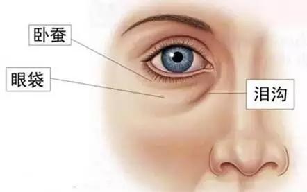 泪沟分三种类型,要针对性治疗!呼市整形医院