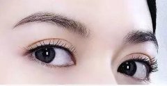 张高贵做双眼皮三种手术方法