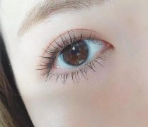 双眼皮手术的误区有哪些?
