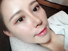哪种开眼角手术方式才适合自己呢